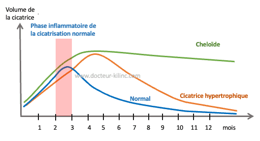 Conseils pratiques - Docteur Kilinc - Chirurgien